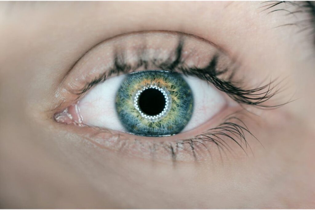 dezlipirea de retina, retina, ochiul uman
