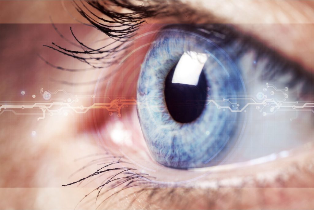 cataractă subcapulară, 