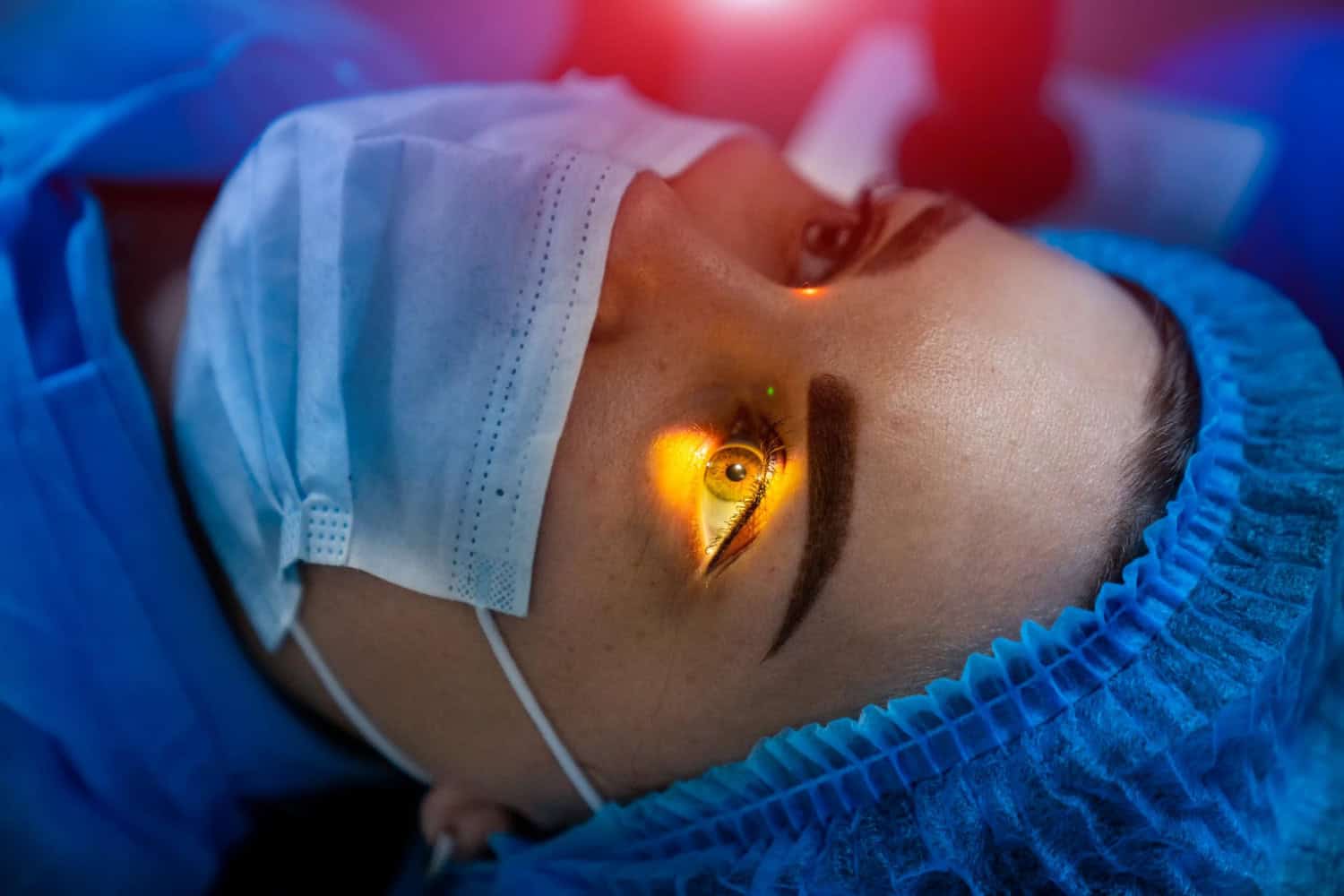 laser, ochi, operatie laser